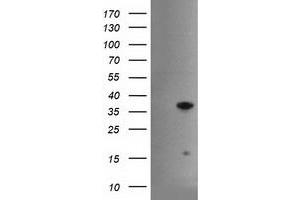 Western Blotting (WB) image for anti-Hes Family bHLH Transcription Factor 1 (HES1) antibody (ABIN1498637) (HES1 抗体)