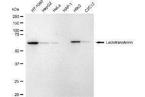 Western blotting analysis using Lactotransferrin antibody (ABIN7799226).