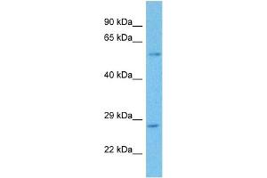 Host:  Rabbit  Target Name:  DERL3  Sample Tissue:  Human Liver Tumor  Antibody Dilution:  1ug/ml (Derlin-3 抗体  (Middle Region))