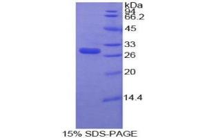 SDS-PAGE analysis of Human MMP16 Protein. (MMP16 蛋白)
