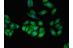 Immunofluorescent analysis of HepG2 cells using ABIN7173913 at dilution of 1:100 and Alexa Fluor 488-congugated AffiniPure Goat Anti-Rabbit IgG(H+L)