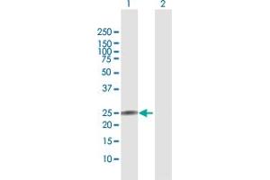 Western Blot analysis of IL22 expression in transfected 293T cell line by IL22 MaxPab polyclonal antibody. (IL-22 抗体  (AA 1-179))