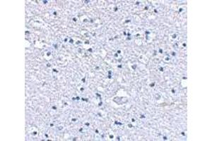 Immunohistochemical staining of human brain tissue using AP30385PU-N Grik4 antibody at 2. (GRIK4 抗体  (N-Term))