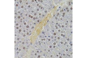 Immunohistochemistry (Paraffin-embedded Sections) (IHC (p)) image for anti-Nuclear Autoantigenic Sperm Protein (Histone-Binding) (NASP) (AA 180-449) antibody (ABIN6144374)