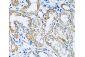Immunohistochemistry (Paraffin-embedded Sections) (IHC (p)) image for anti-rho Guanine Nucleotide Exchange Factor (GEF) 5 (ARHGEF5) antibody (ABIN7259516)