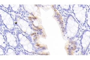 Immunohistochemistry (IHC) image for anti-Galectin 3 (LGALS3) (AA 1-262) antibody (ABIN7427336)