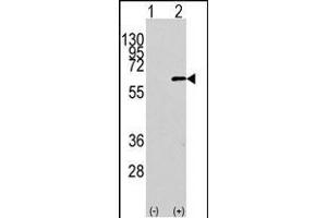 Western blot analysis of AKT1 Antibody (N-term) polyclonal antibody (ABIN391212 and ABIN2841290) (arrow).