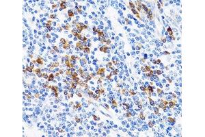 Immunohistochemistry of paraffin-embedded Human tonsil using TNFSF12 Polyclonal Antibody at dilution of 1:100 (40x lens). (TWEAK 抗体)
