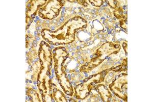 Immunohistochemistry of paraffin-embedded rat kidney using LAMP3 antibody (ABIN5971497) at dilution of 1/100 (40x lens). (LAMP3 抗体)