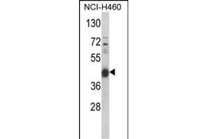 Western blot analysis of PRKACA Antibody (N-term K82) (ABIN390798 and ABIN2841043) in NCI- cell line lysates (35 μg/lane). (PRKACA 抗体  (N-Term))