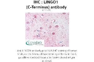 Image no. 1 for anti-Leucine Rich Repeat and Ig Domain Containing 1 (LINGO1) (C-Term) antibody (ABIN1736452) (LINGO1 抗体  (C-Term))