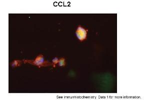Sample Type: Human Macrophange CellsGreen: primaryRed: phallodinBlue: DAPIYellow: green/redPrimary Dilution: 1:200Secondary Antibody: anti-Rabbit IgG-FITCSecondary Dilution: 1:1000Image Submitted By: Milan FialaUniversity of California, Los Angeles (CCL2 抗体  (Middle Region))