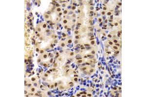 Immunohistochemistry of paraffin-embedded human stomach using XRCC5 Antibody.