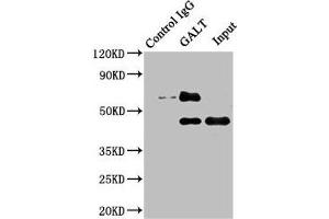 Western Blotting (WB) image for anti-Galactose-1-Phosphate Uridylyltransferase (GALT) (AA 1-379) antibody (ABIN7153422)