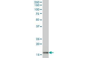AGR2 monoclonal antibody (M03), clone 1C3 Western Blot analysis of AGR2 expression in MCF-7 . (AGR2 抗体  (AA 1-175))