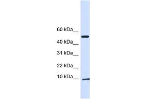 WB Suggested Anti-ATPIF1 Antibody Titration:  0. (ATPase Inhibitory Factor 1 抗体  (N-Term))