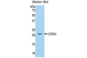 Western Blotting (WB) image for anti-Lecithin-Cholesterol Acyltransferase (LCAT) (AA 41-210) antibody (ABIN1176768) (LCAT 抗体  (AA 41-210))