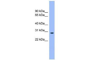 ENOPH1 antibody used at 1 ug/ml to detect target protein. (MASA 抗体  (N-Term))