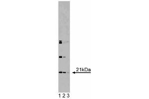 Western blot analysis of DHFR on RSV-3T3 lysate. (Dihydrofolate Reductase 抗体  (AA 1-186))