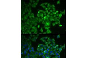 Immunofluorescence (IF) image for anti-V-Raf-1 Murine Leukemia Viral Oncogene Homolog 1 (RAF1) antibody (ABIN7254803)