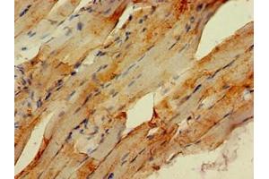 Immunohistochemistry of paraffin-embedded human skeletal muscle tissue using ABIN7151009 at dilution of 1:100 (STUB1 抗体  (AA 1-48))