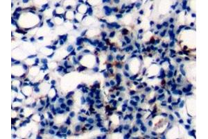 Detection of CD45 in Mouse Kidney Tissue using Polyclonal Antibody to Protein Tyrosine Phosphatase Receptor Type C (CD45)