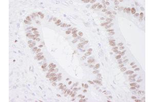 Immunohistochemistry (IHC) image for anti-Minichromosome Maintenance Complex Component 3 (MCM3) (AA 500-550) antibody (ABIN7448652) (MCM3 抗体  (AA 500-550))