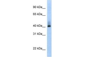 Western Blotting (WB) image for anti-Ankyrin Repeat Domain 42 (ANKRD42) antibody (ABIN2462361) (ANKRD42 抗体)