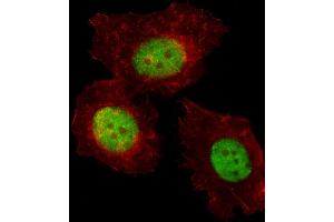 Fluorescent image of MCF-7 cell stained with TREF1 Antibody (C-term) (ABIN653305 and ABIN2842805). (TRERF1 抗体  (C-Term))