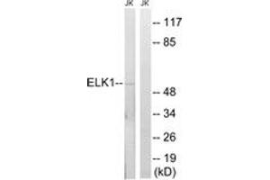 Western blot analysis of extracts from JurKat cells, using Elk1 (Ab-383) Antibody. (ELK1 抗体  (AA 351-400))