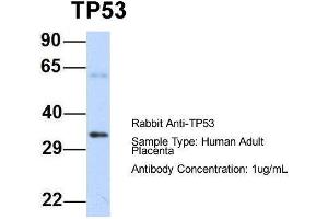 Host: Rabbit  Target Name: TP53  Sample Tissue: Human Adult Placenta  Antibody Dilution: 1. (p53 抗体  (N-Term))