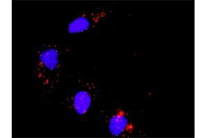 Proximity Ligation Analysis of protein-protein interactions between MAPK3 and ATF2. (ATF2 抗体  (AA 91-190))