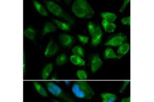 Immunofluorescence analysis of HepG2 cells using KIR2DL3 Polyclonal Antibody (KIR2DL3 抗体)