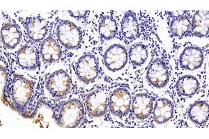 Detection of PALLD in Human Colon Tissue using Polyclonal Antibody to Palladin (PALLD) (PALLD 抗体  (AA 1137-1383))