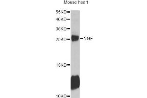 Western blot analysis of extracts of mouse heart, using NGF antibody (ABIN6293296) at 1:1000 dilution. (Nerve Growth Factor 抗体)