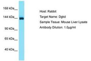 Image no. 1 for anti-Diacylglycerol Kinase, delta 130kDa (DGKD) (AA 449-498) antibody (ABIN6750521)