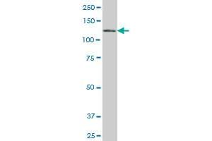 EPB41L3 monoclonal antibody (M01), clone 2B1 Western Blot analysis of EPB41L3 expression in HepG2 . (EPB41L3 抗体  (AA 915-1007))