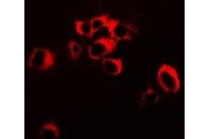 Immunofluorescent analysis of RNF81 staining in SW620 cells. (TRIM21 抗体)