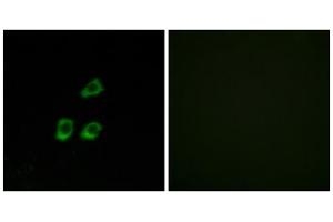 Immunofluorescence analysis of HUVEC cells, using CLCN4 antibody. (CLCN4 抗体  (Internal Region))