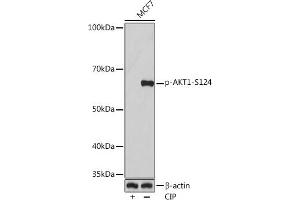 Western blot analysis of extracts of MCF7 cells, using Phospho--S124 Rabbit mAb (ABIN7271245) at 1:1000 dilution. (AKT1 抗体  (pSer124))