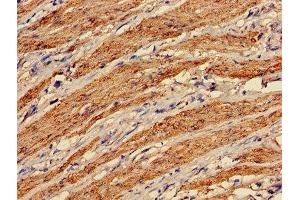 Immunohistochemistry of paraffin-embedded human smooth muscle tissue using ABIN7172847 at dilution of 1:100 (Transgelin 抗体  (AA 2-201))