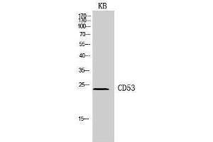 Western Blotting (WB) image for anti-CD53 (CD53) (Internal Region) antibody (ABIN3181436) (CD53 抗体  (Internal Region))
