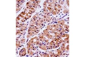Immunohistochemistry analysis in formalin fixed and paraffin embedded human stomach tissue reacted with KLK15 / Kallikrein-15 Antibody (Center) followed by peroxidase conjugation of the secondary antibody and DAB staining. (Kallikrein 15 抗体  (Middle Region))