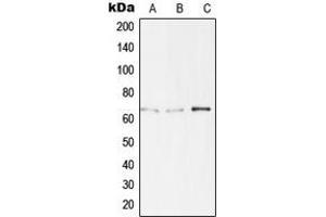 Western blot analysis of TBX15/18 expression in Jurkat (A), HepG2 (B), LOVO (C) whole cell lysates.
