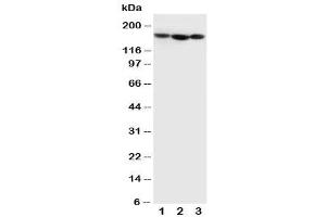Western blot testing of Collagen IV antibody and Lane 1:  MCF-7 (COL4A1 抗体  (C-Term))