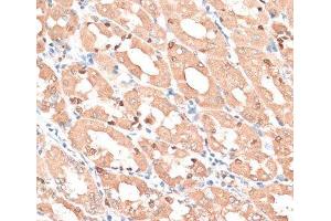 Immunohistochemistry of paraffin-embedded Human stomach using HMGA1 Polyclonal Antibody at dilution of 1:100 (40x lens). (HMGA1 抗体)