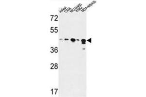 Western Blotting (WB) image for anti-Alcohol Dehydrogenase 7 (Class IV), mu Or sigma Polypeptide (ADH7) (AA 325-354), (C-Term) antibody (ABIN950340)