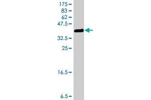 Western Blot detection against Immunogen (37 KDa) . (PERK 抗体  (AA 665-764))