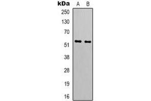 Western blot analysis of GIP Receptor expression in HT1080 (A), A549 (B) whole cell lysates. (GIPR 抗体)