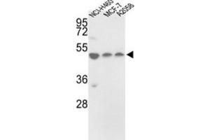 Western Blotting (WB) image for anti-Protein Disulfide Isomerase Family A, Member 6 (PDIA6) antibody (ABIN3002738) (PDIA6 抗体)